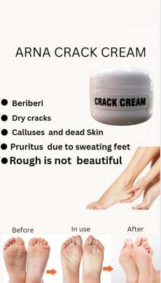 ARNA CRACK CREAM 0